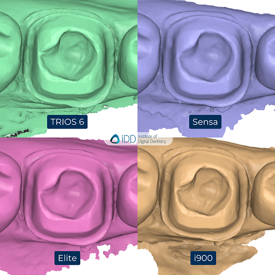 4-3Shape-TRIOS-6-Alliedstar-Sensa-Shining-3D-Aoralscan-Elite-Medit-i900-intraoral-scanner-ios-idd-compares-lower-stl-scan-medit-design