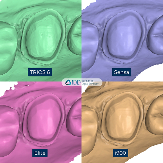 4-3Shape-TRIOS-6-Alliedstar-Sensa-Shining-3D-Aoralscan-Elite-Medit-i900-intraoral-scanner-ios-idd-compares-upper-stl-scan-medit-design
