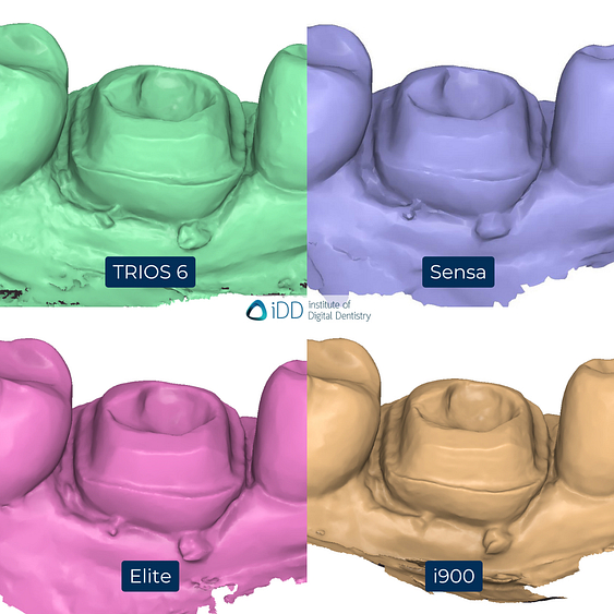 5-3Shape-TRIOS-6-Alliedstar-Sensa-Shining-3D-Aoralscan-Elite-Medit-i900-intraoral-scanner-ios-idd-compares-lower-stl-scan-buccal-margin-prep-view