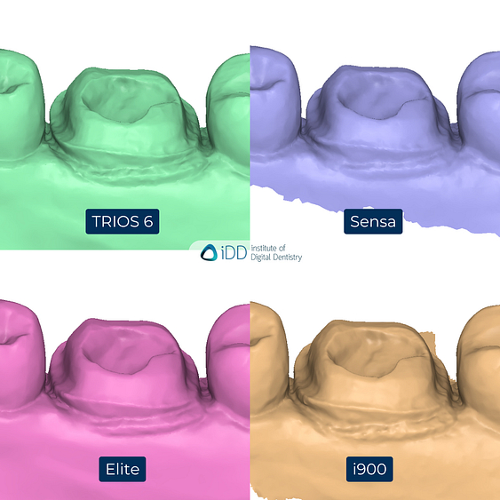 6-3Shape-TRIOS-6-Alliedstar-Sensa-Shining-3D-Aoralscan-Elite-Medit-i900-intraoral-scanner-ios-idd-compares-lower-stl-scan-lingual-margin-prep-view