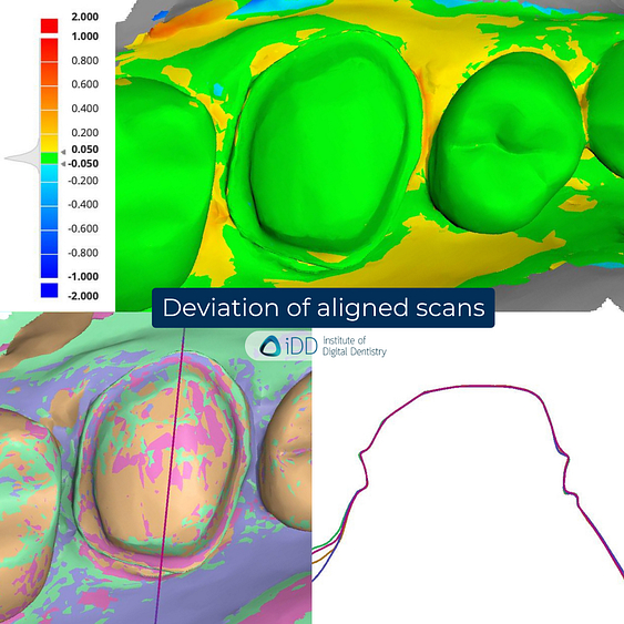 8-3Shape-TRIOS-6-Alliedstar-Sensa-Shining-3D-Aoralscan-Elite-Medit-i900-intraoral-scanner-ios-idd-compares-upper-stl-scan-deviation-analysis-accuracy