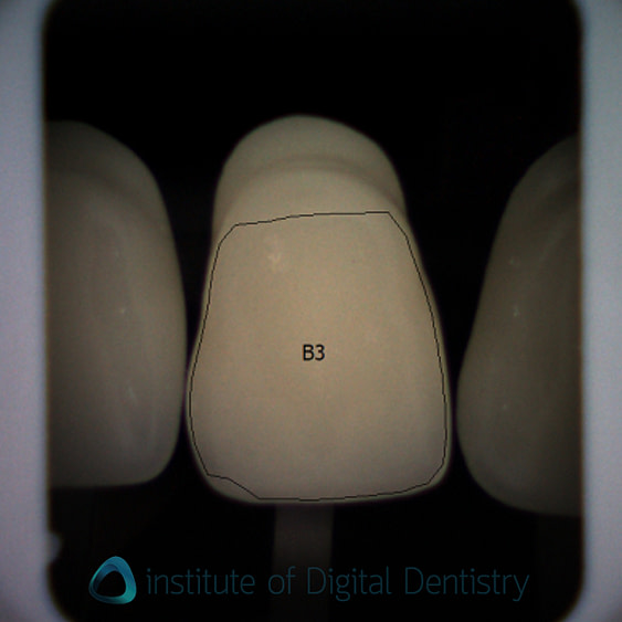 shade_guide_test_borea3