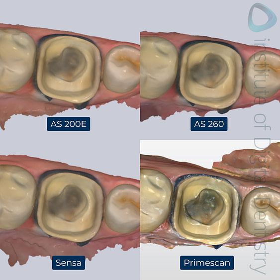 2-Alliedstar-AS260-AS200E-Sensa-Dentsply-Sirona-Primescan-intraoral-scanner-ios-idd-compares-lower-native-color