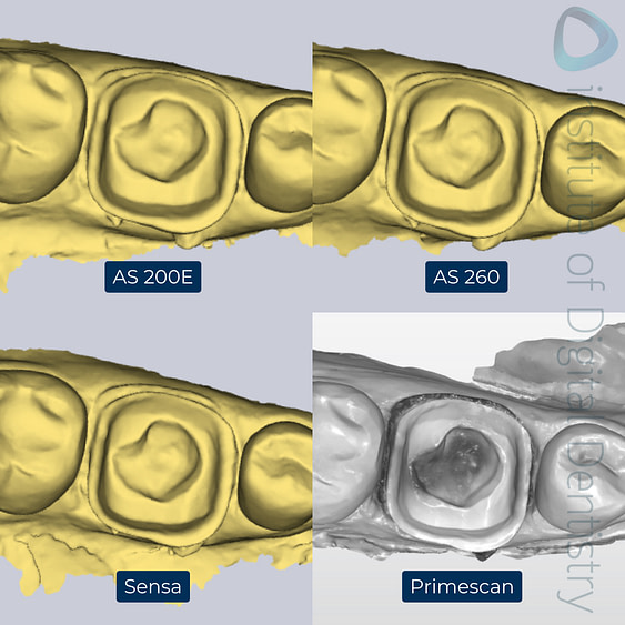 3-Alliedstar-AS260-AS200E-Sensa-Dentsply-Sirona-Primescan-intraoral-scanner-ios-idd-compares-lower-native-monochrome