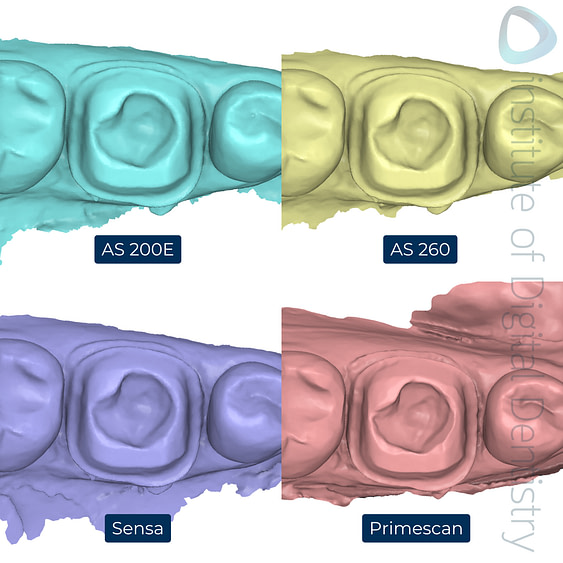 4-Alliedstar-AS260-AS200E-Sensa-Dentsply-Sirona-Primescan-intraoral-scanner-ios-idd-compares-lower-stl-scan