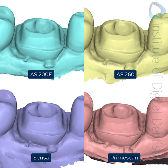 5-Alliedstar-AS260-AS200E-Sensa-Dentsply-Sirona-Primescan-intraoral-scanner-ios-idd-compares-lower-margin-prep-buccal