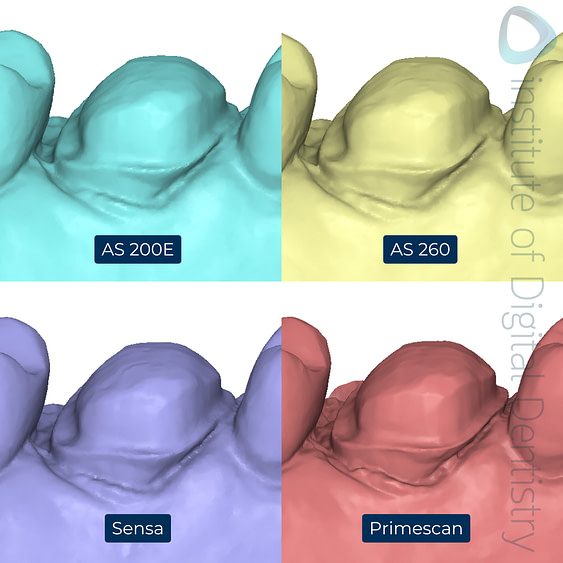 7-Alliedstar-AS260-AS200E-Sensa-Dentsply-Sirona-Primescan-intraoral-scanner-ios-idd-compares-upper-margin-prep-palatal