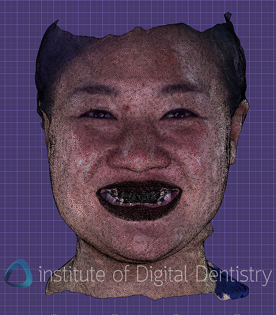 metismile_rayface_qlone_dental_face_scanners (5)