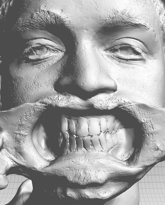 Qlone_dental_pro_iDD