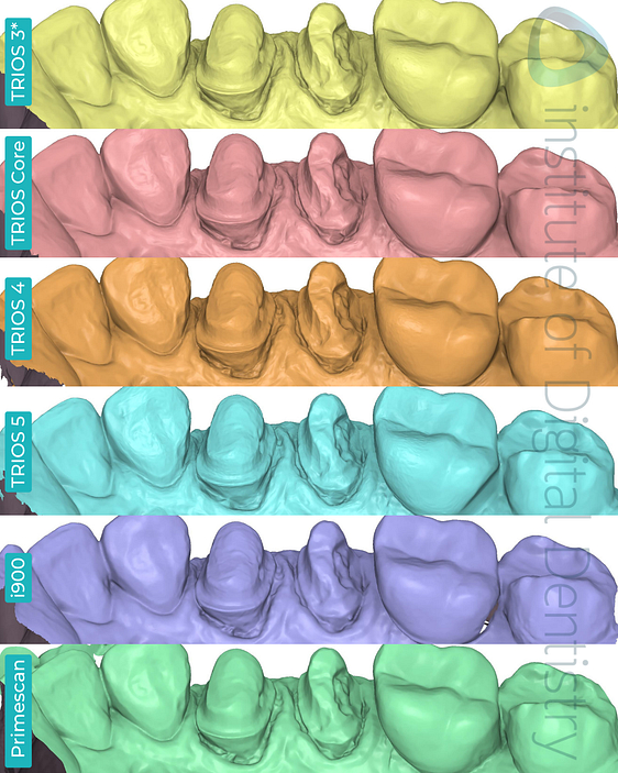 3shape-trios-3-updated-4-5-core-medit-i900-dentsply-sirona-cerec-primescan-intraoral-scanner-institute-of-digital-dentistry-idd-compares-blog-medit-design-app-stl-file-format-margin-prep-line-palatal-view