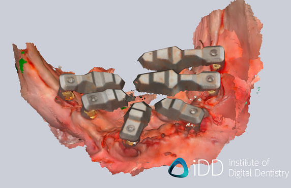 allied_star_Direct_IP_IDD1