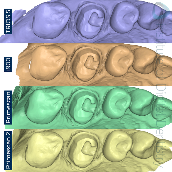 dentsply-sirona-primescan-2-3shape-trios-5-medit-i900-cerec-primescan-intraoral-scanner-comparison-idd-compares-institute-of-digital-dentistry-blog-stl-scan-file-format-medit-design