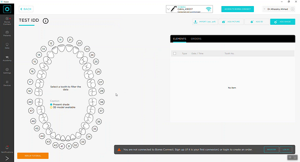 borea_cobra_review_iDD_institute_of_digital_dentistry (2)