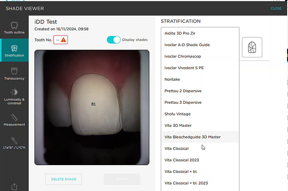 borea_cobra_review_iDD_institute_of_digital_dentistry (4)