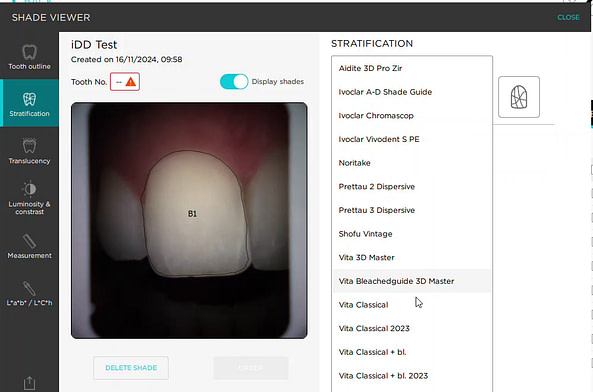 borea_cobra_review_iDD_institute_of_digital_dentistry (4)
