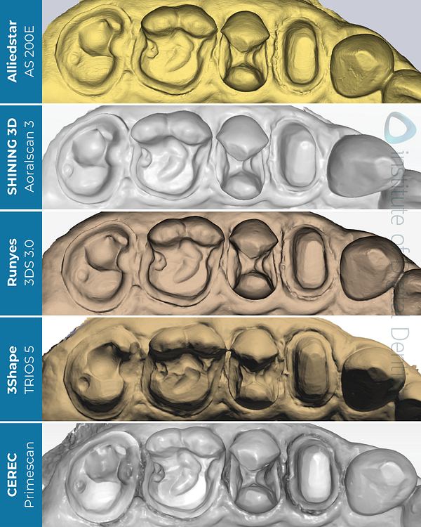 idd-compares-alliedstar-as200e-shining-3d-aoralscan3-dentsply-sirona-cerec-primescan-runyes-3ds-3-3shape-trios5-intraoral-scanner-monochrome-processed-native-scans