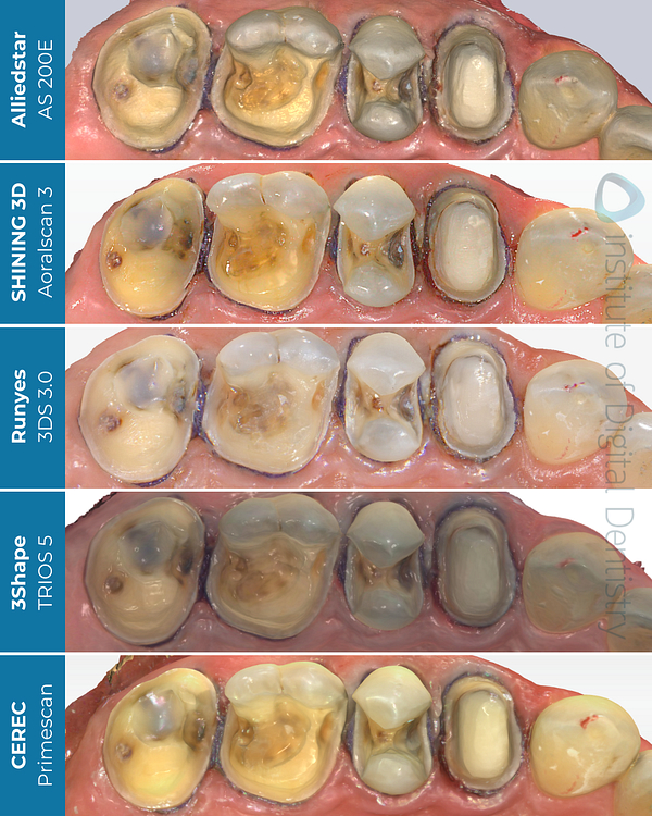 idd-compares-alliedstar-as200e-shining-3d-aoralscan3-dentsply-sirona-cerec-primescan-runyes-3ds-3-3shape-trios5-intraoral-scanner-processed-color-native-scans