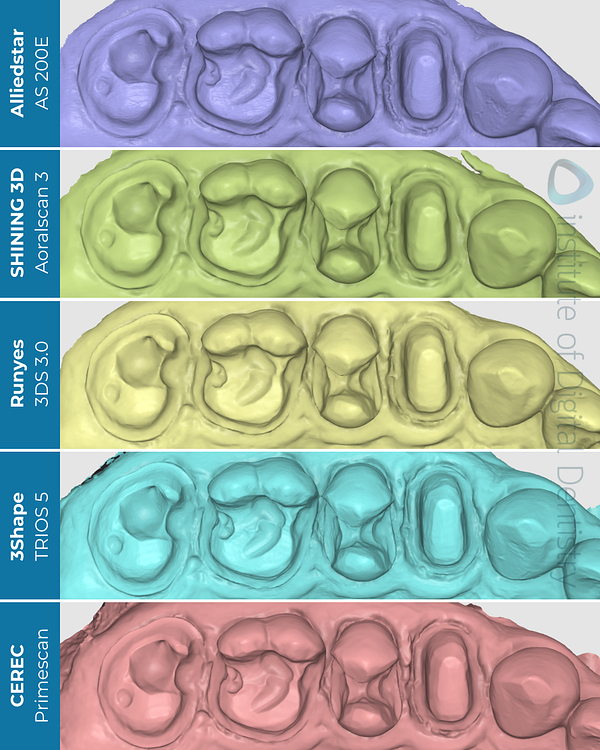 idd-compares-alliedstar-as200e-shining-3d-aoralscan3-dentsply-sirona-cerec-primescan-runyes-3ds-3-3shape-trios5-intraoral-scanner-stl-medit-design-scans