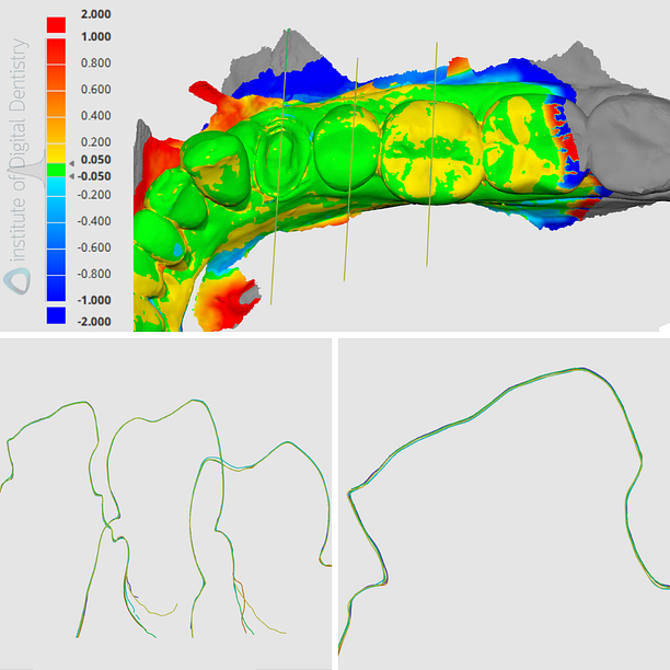 iDD-compares-deviation-alignment
