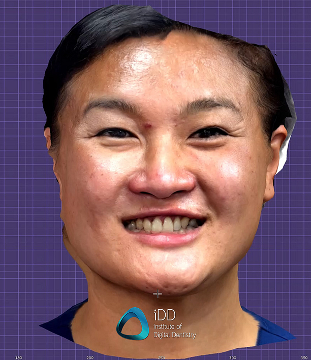 dental face scanners (2)