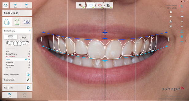TRIOS Smile Design 22