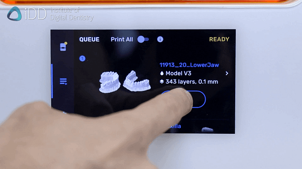 3d-printing-dental-model-idd-initiate-printing-process