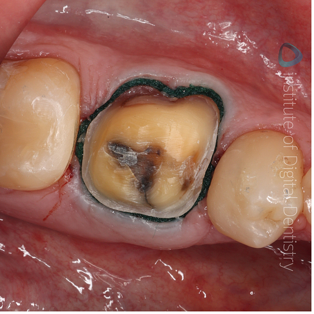 medit-i900-itero-lumina-cerec-primescan-3shape-trios-5-shining-3d-aoralscan-3-intraoral-scanner-idd-compares-institute-of-digital-dentistry-photo