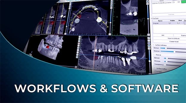 Online Digital Implant Planning Guide And Workflows