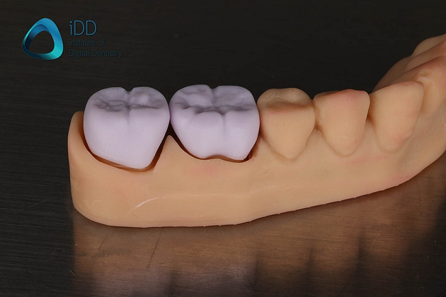 figure-9-e-max-crowns-post-processing Figure 9. IPS e.max crowns before and after post-processing including ceramic characterisation, glazing and firing.