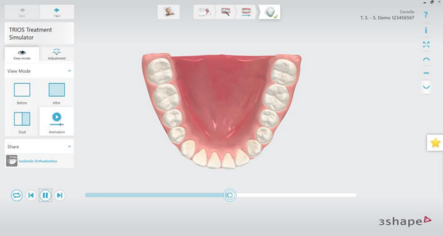 TRIOS Treatment SImulator