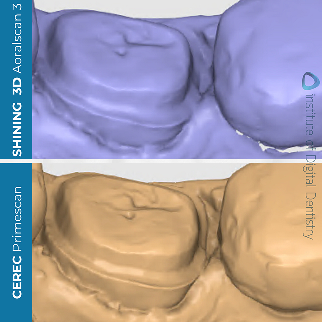 idd-compares-shining-3d-dental-aoralscan-3-dentsply-sirona-cerec-primescan-medit-design-stl-cad-software-prep-margin