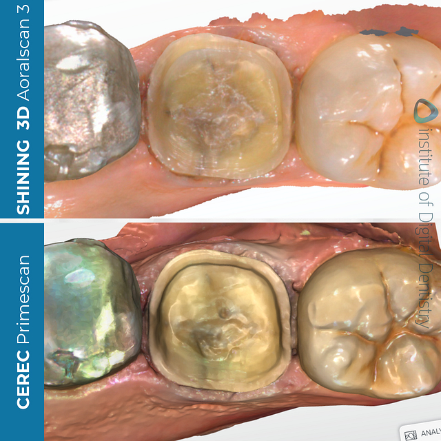idd-compares-shining-3d-dental-aoralscan-3-dentsply-sirona-cerec-primescan-color-scans-native-software-intraoral-scanning