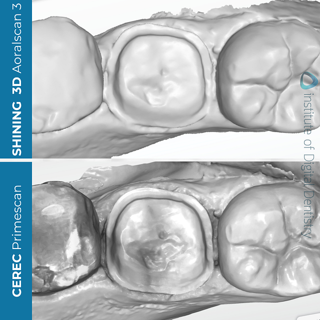 idd-compares-shining-3d-dental-aoralscan-3-dentsply-sirona-cerec-primescan-monochrome-scans-native-software-intraoral-scanning