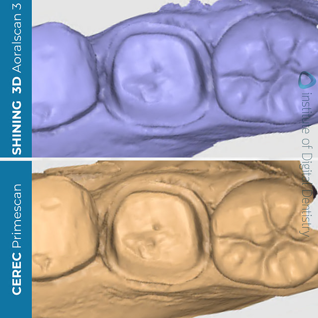 idd-compares-shining-3d-dental-aoralscan-3-dentsply-sirona-cerec-primescan-medit-design-stl-cad-software