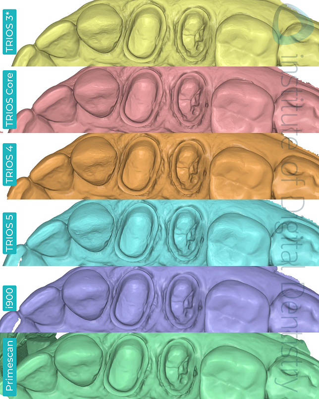 3shape-trios-3-updated-4-5-core-medit-i900-dentsply-sirona-cerec-primescan-intraoral-scanner-institute-of-digital-dentistry-idd-compares-blog-medit-design-app-stl-file-format