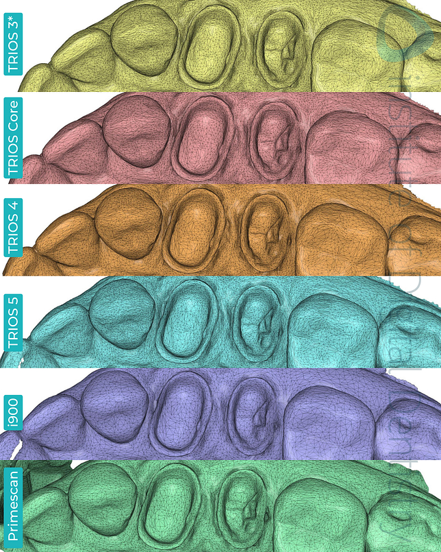 3shape-trios-3-updated-4-5-core-medit-i900-dentsply-sirona-cerec-primescan-intraoral-scanner-institute-of-digital-dentistry-idd-compares-blog-medit-design-app-stl-file-format-tessellation-mesh-density