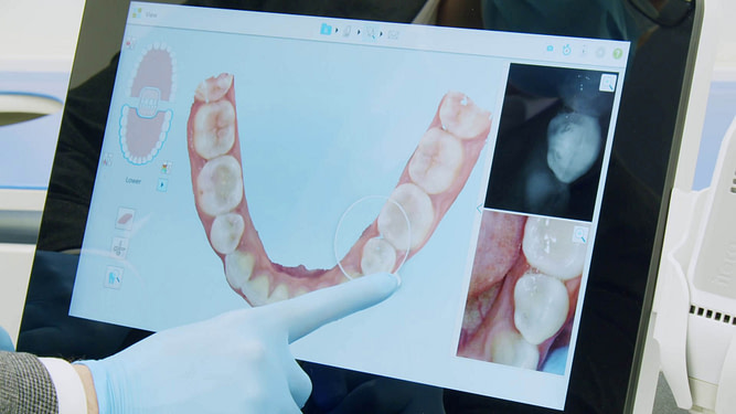 niri-itero-element-5d-plus-unboxing-idd niri-itero-element-5d-plus-unboxing-idd