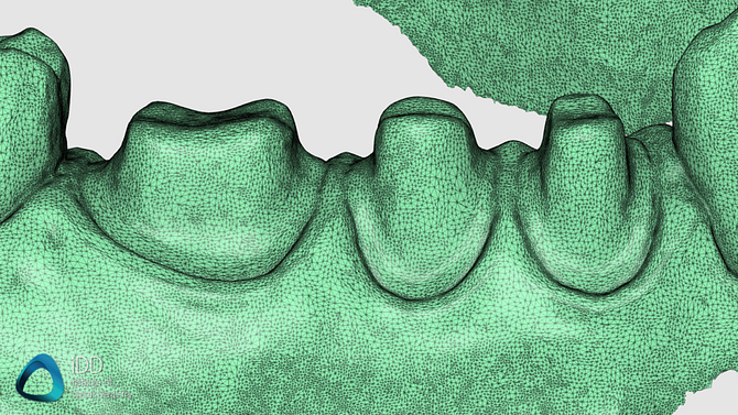 aoralscan 3 accuracy institute of digital dentistry (2)