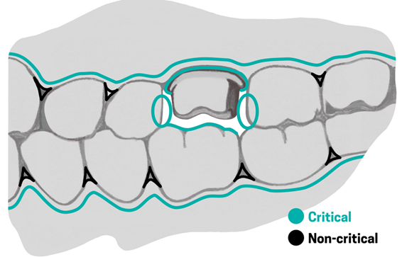 top five mistakes when scanning institute of digital dentistry iDD (1)
