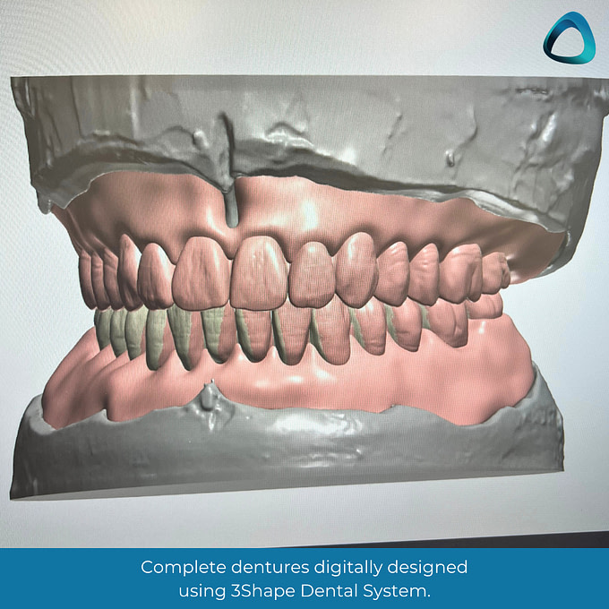 idd-digital-dentures-blog-cad-design-mill-ivotion-ivoclar
