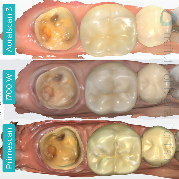 idd-compares-shining-3d-dental-aoralscan-3-medit-i700w-dentsply-sirona-cerec-primescan-intraoral-scanner-color-scan-native-software