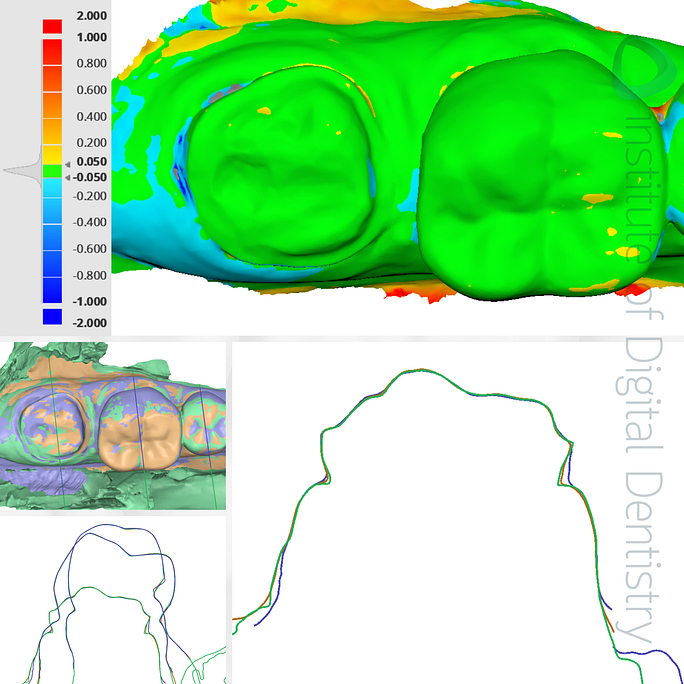 idd-compares-shining-3d-dental-aoralscan-3-medit-i700w-dentsply-sirona-cerec-primescan-intraoral-scanner-deviation-alignment