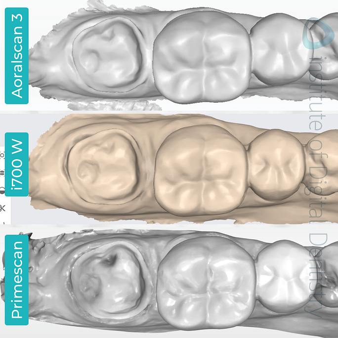 idd-compares-shining-3d-dental-aoralscan-3-medit-i700w-dentsply-sirona-cerec-primescan-intraoral-scanner-monochrome-scan-native-software.png