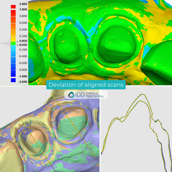 idd-compares-intraoral-scanners-3shape-trios3-medit-i500-i700-dentsply-sirona-cerec-primescan-deviation-map-alignment