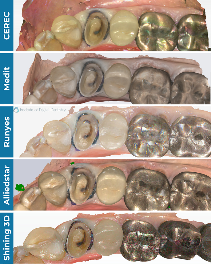 iDD-compares-color-scans