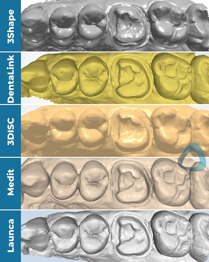 monochrome-scans-compare-cheap-intraoral-scanners-trios-4-launca-dl-206p-dentalink-s6000-3disc-heron-medit-i700