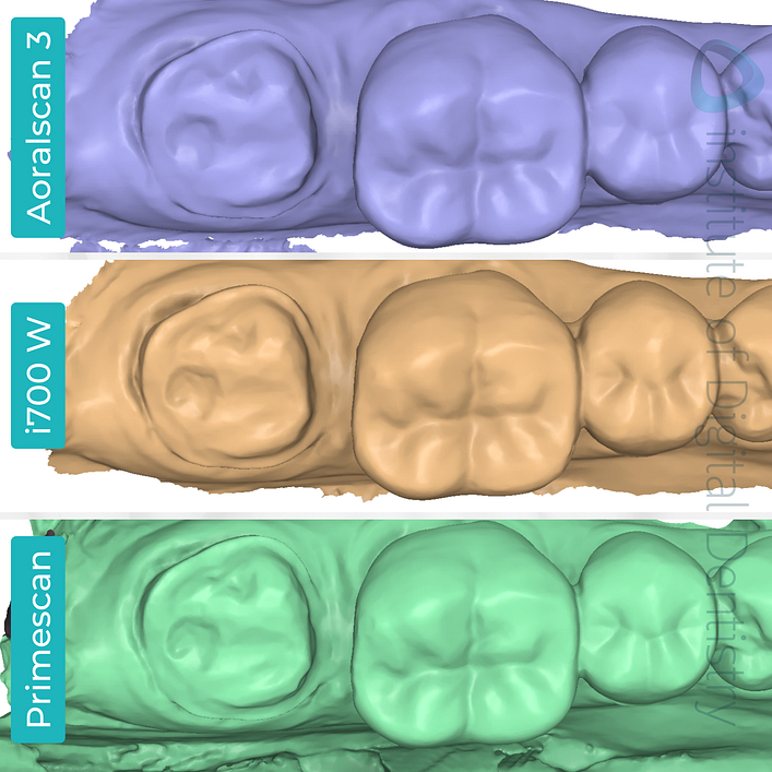 idd-compares-shining-3d-dental-aoralscan-3-medit-i700w-dentsply-sirona-cerec-primescan-intraoral-scanner-medit-design-stl-file