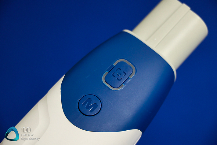 alliedstar AS 200E wireless intraoral scanner institute of digital dentistry (9)