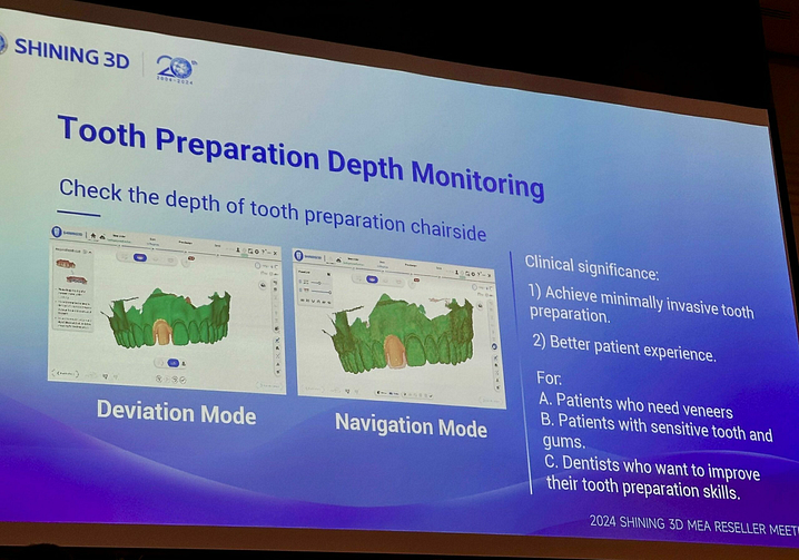 Shining 3D MEA event new intraoral scanner elite (5)