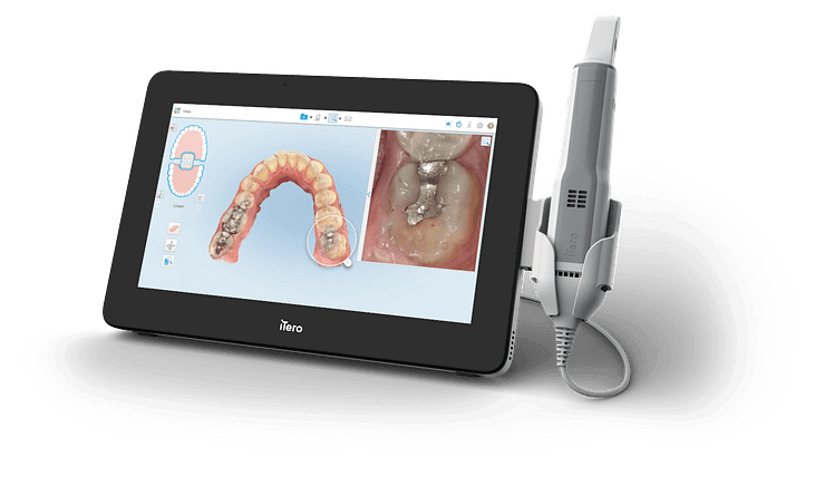 itero element 5d scanner mobile version plus series